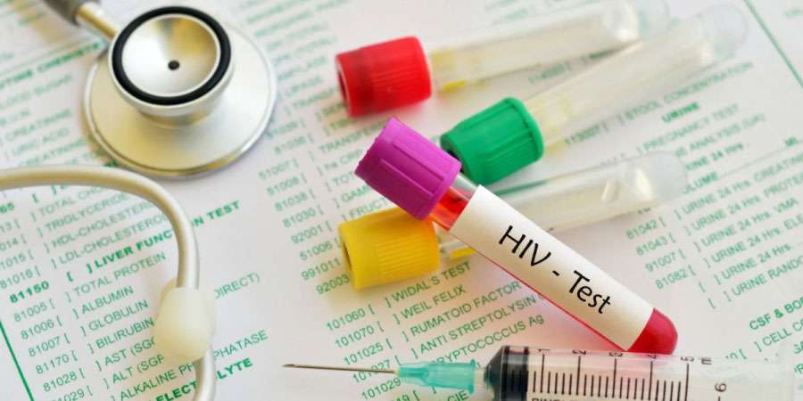 AIDS Testi Neden Yapılır? Kimler Test Yaptırmalı?