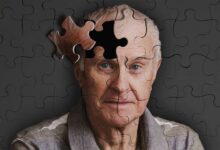 Alzheimer Riski %45 Azaltılabilir: Uzmanından Hayati Uyarılar ve Korunma Rehberi