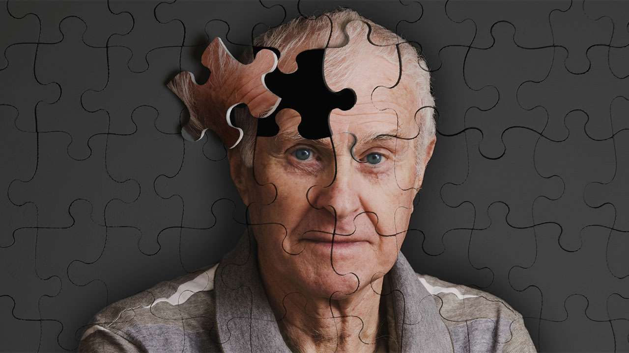 Alzheimer Riski %45 Azaltılabilir: Uzmanından Hayati Uyarılar ve Korunma Rehberi